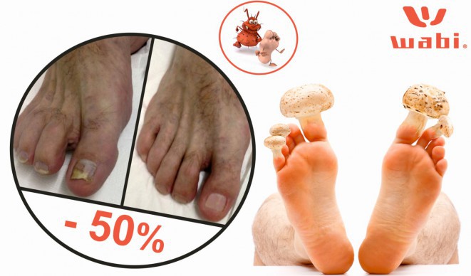 Gesunde Nägel jetzt bis zu 50% günstiger